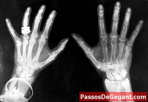 A német tudós röntgenfelvételeket fedez fel